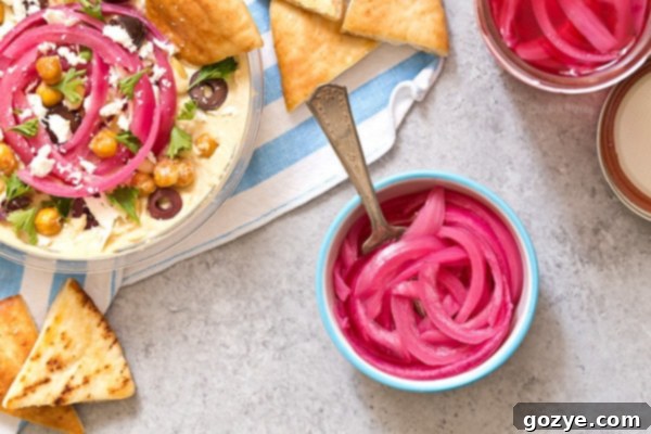 Quick Pickled Red Onions 5 Pickled Red Onions and Hummus Bar
